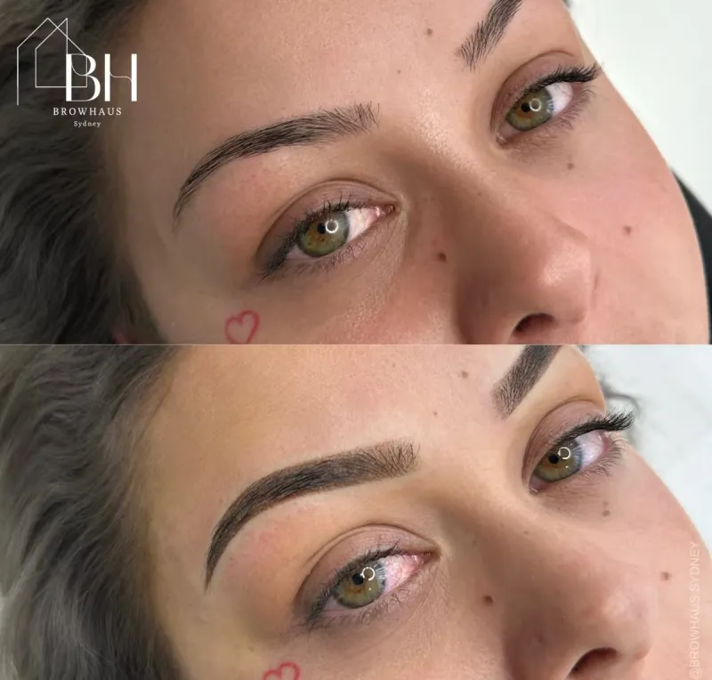 Brow transformation before and after result 2 at Browhaus Sydney