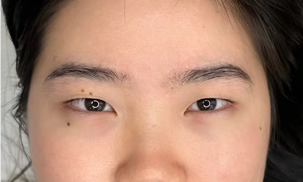 Brow Lamination Sydney - Before