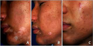 Sixteen-year-old male patient