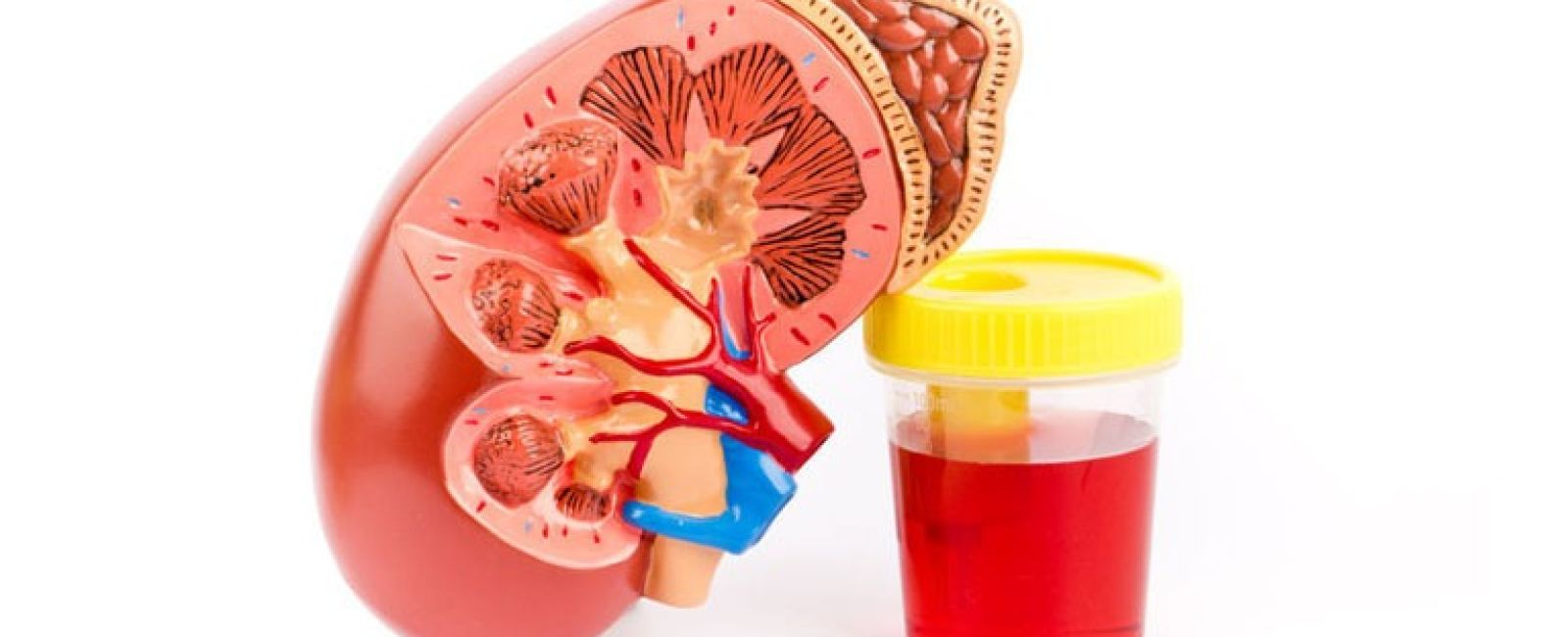 blood-in-urine