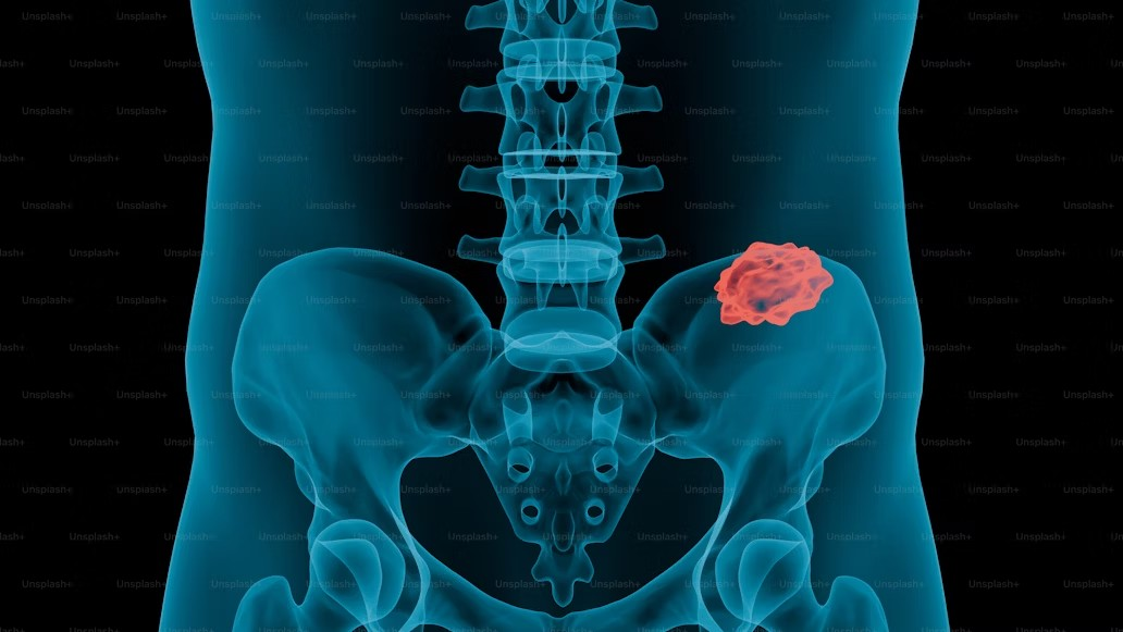 a scan revealing the picture of a patient’s bones