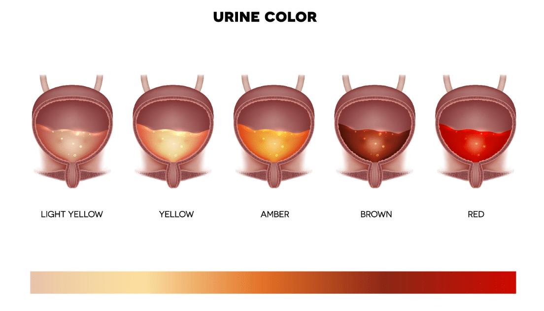 urine-colors