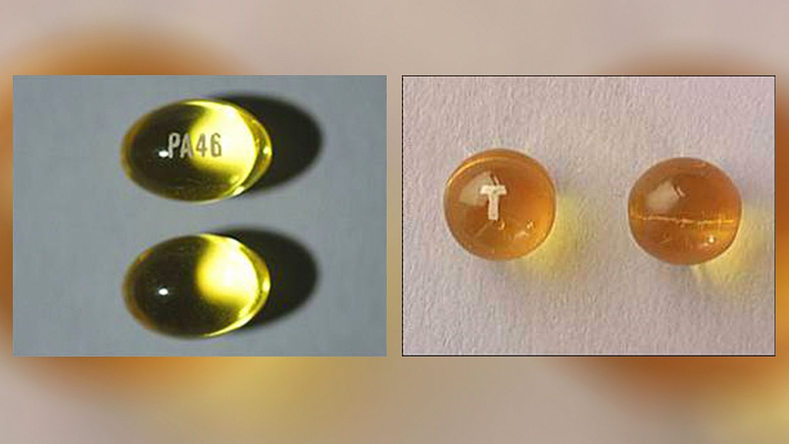 What to look for in a Tessalon Perles
