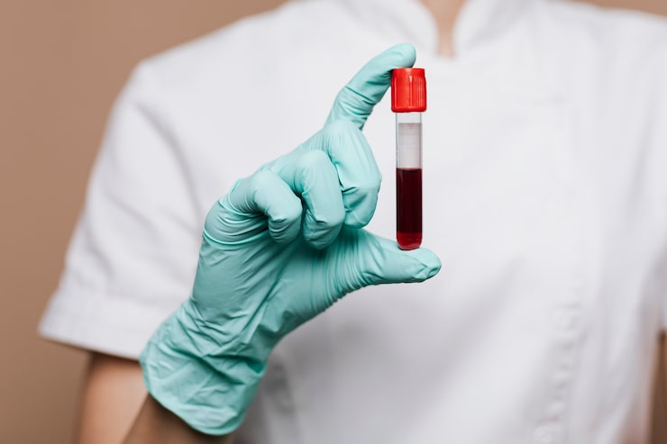 Featured image for: RDW Blood Test Facts for Better Awareness