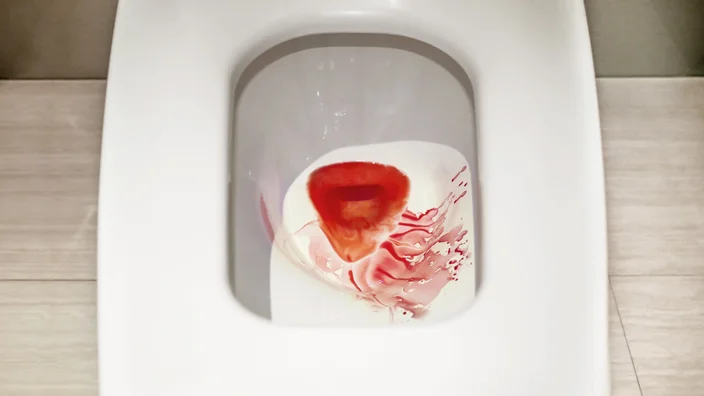 having-a-blood-urine