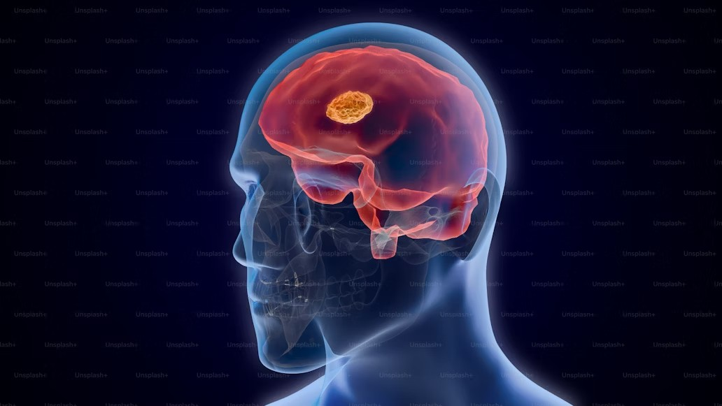 human brain