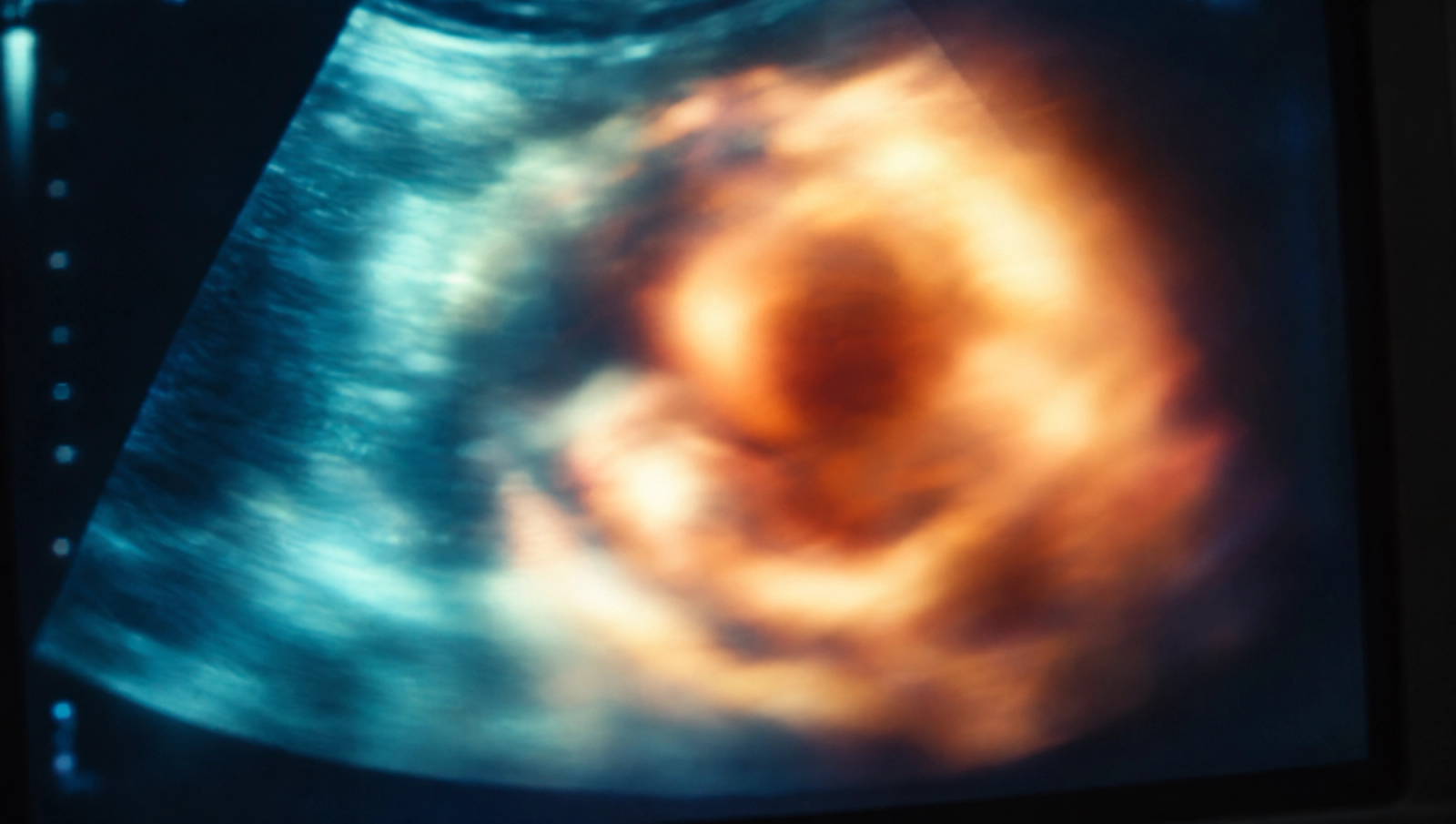 Blurred ultrasound screen in teal and warm orange tones, symbolizing pregnancy and private health insurance (PKV) benefits for women.