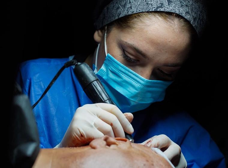 Clinician carrying out a hair restoration procedure