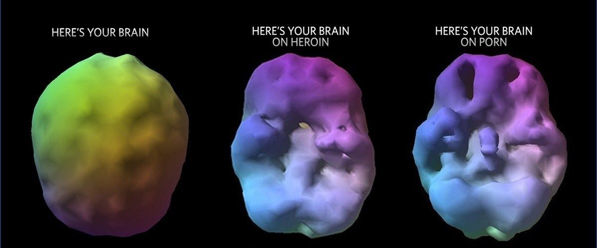 cover image for This Is What Your Brain On Porn Looks Like
