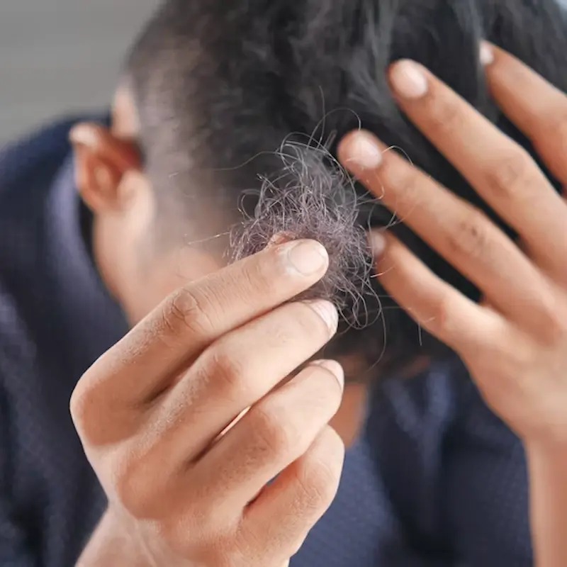 New Review Examines Herbal-Based Remedies for Hair Loss