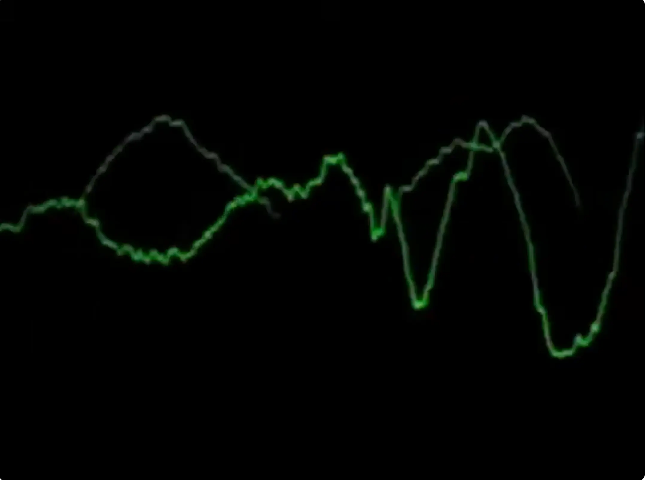 Heart Beat