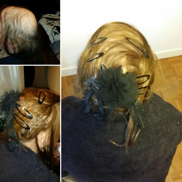 Transformation Maximale - Avant/Après 5