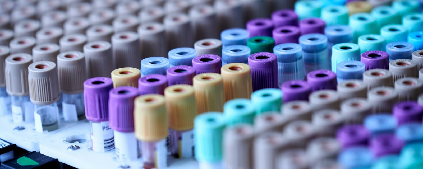 Rows of medical blood collection tubes with colorful caps in a laboratory rack