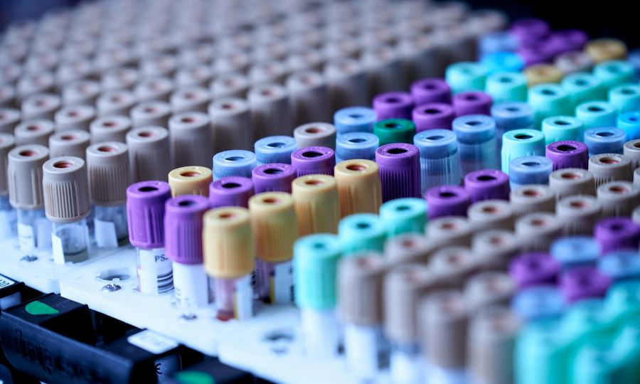 Rows of medical blood collection tubes with colorful caps in a laboratory rack