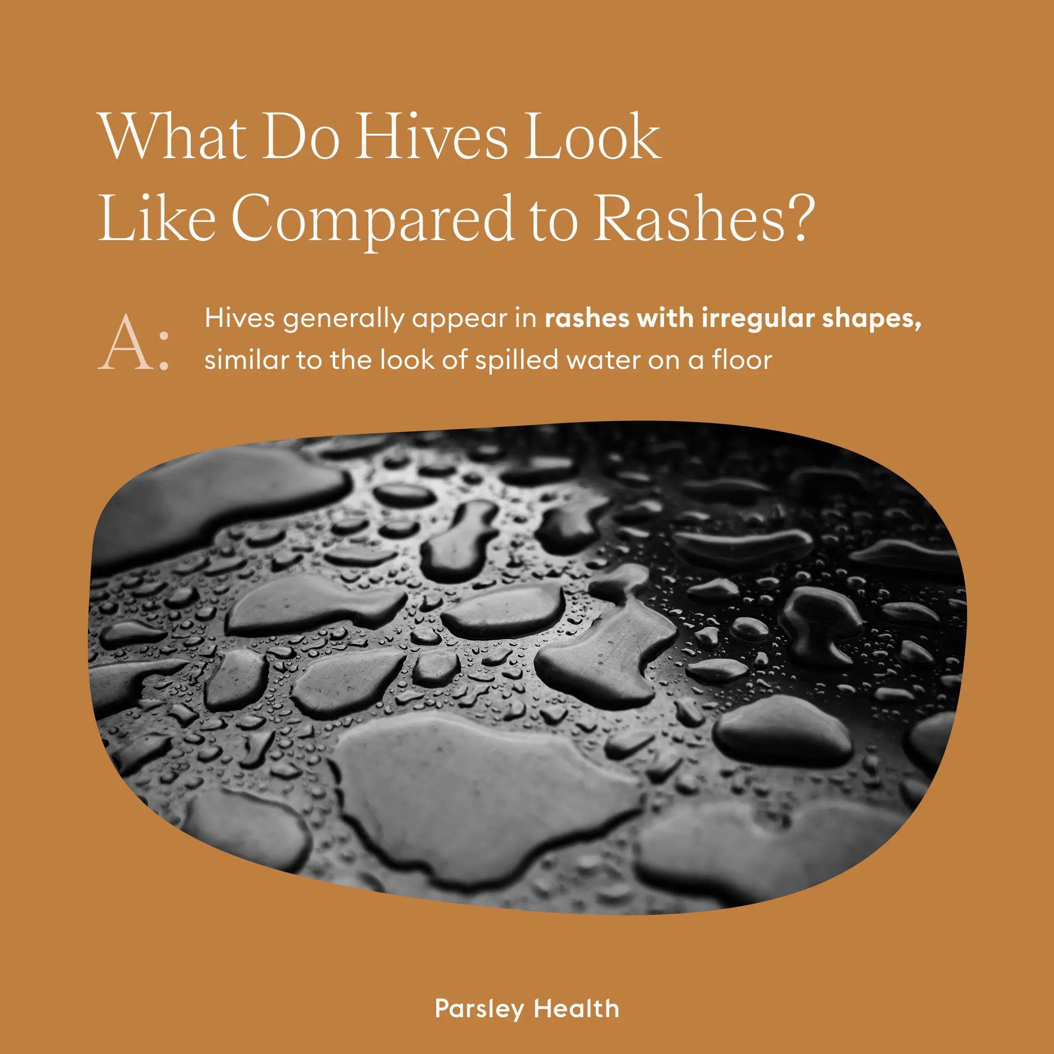 hives have irregular shapes