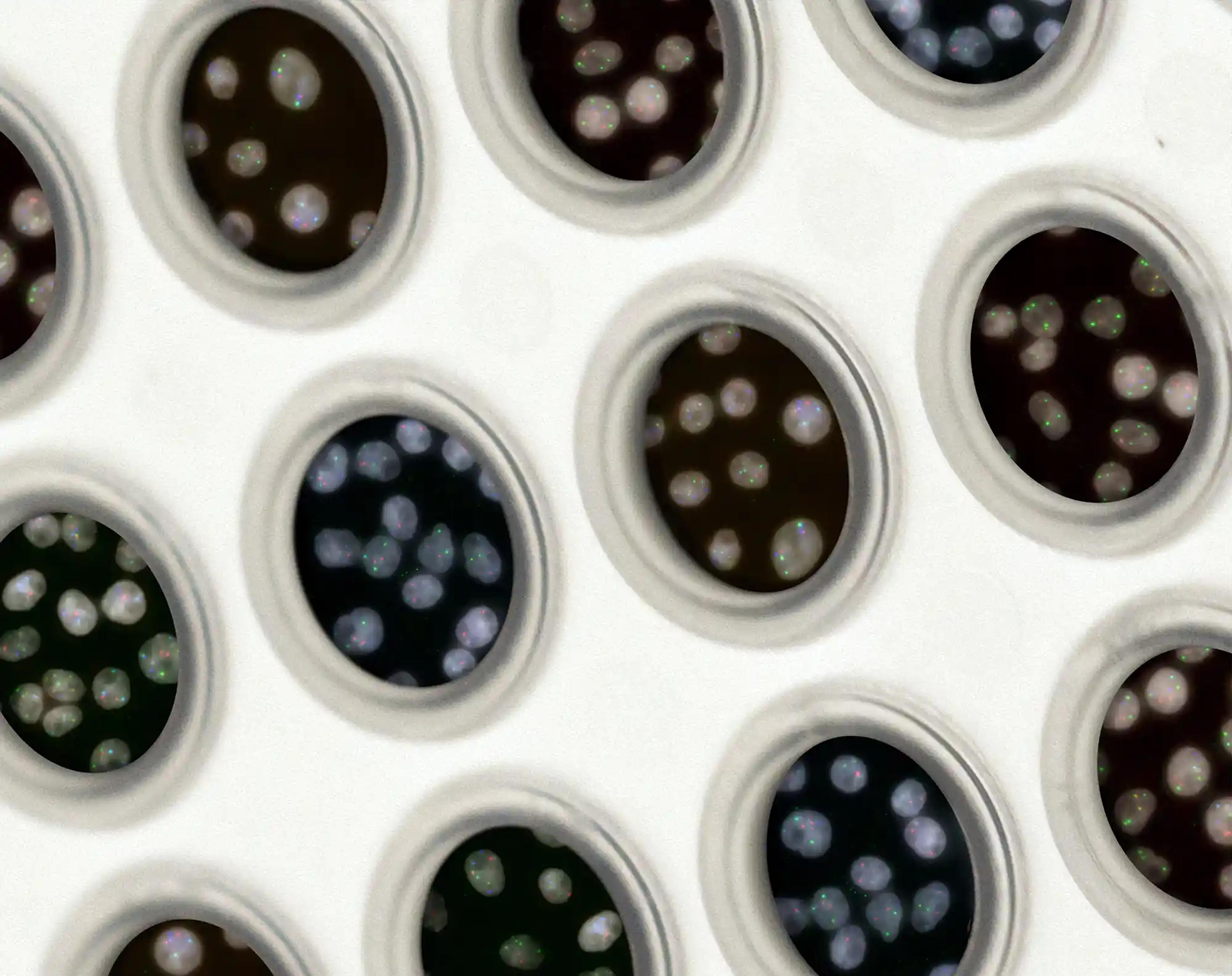 MTHFR Gene Mutation: Symptoms, Testing, and 6 Natural Treatments Options