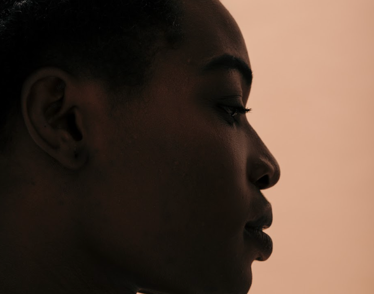 Why Autoimmune Diseases Disproportionately Affect Women