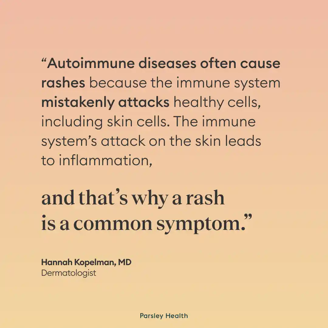 rash and autoimmunity quote
