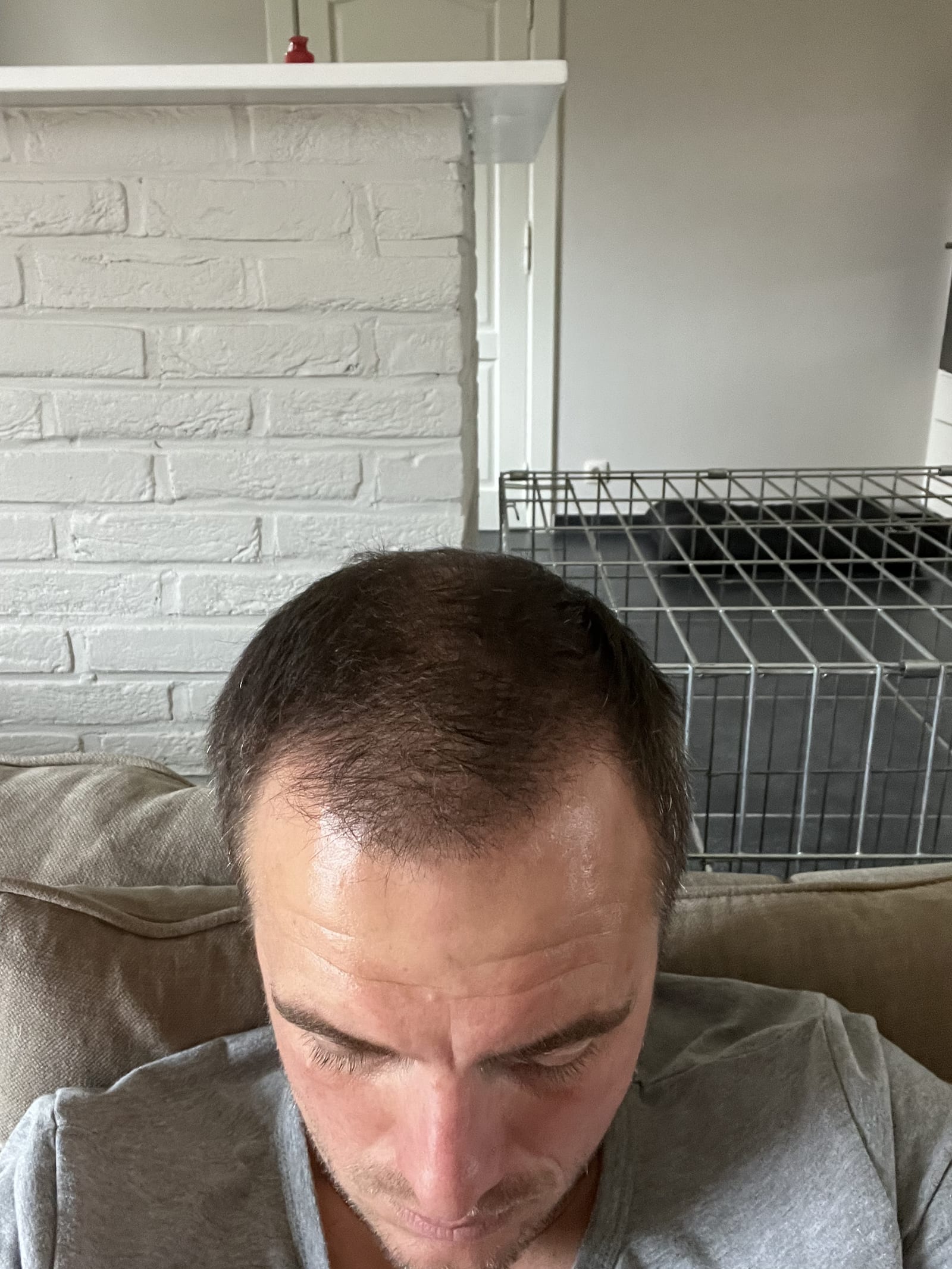 Voor-foto — Haar