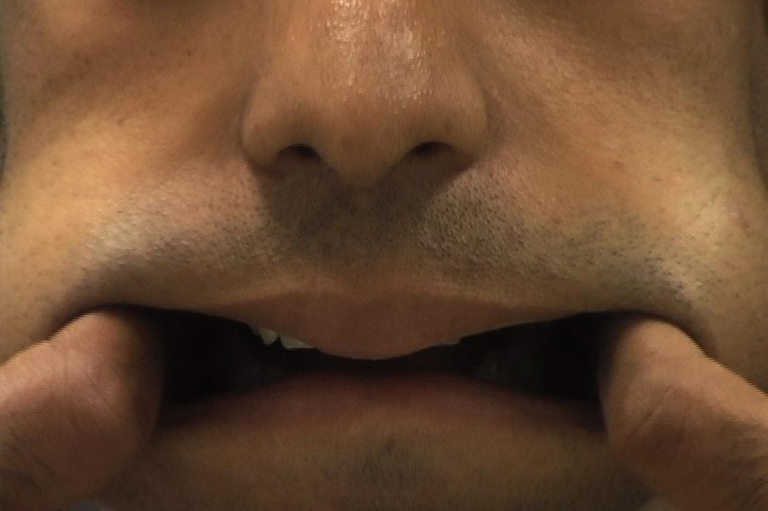 Eine Nahaufnahme des Gesichts eines weißen Mannes, auf dem nur Nase und Mund zu sehen sind. Beide Zeigefinger ziehen die Mundwinkel auseinander