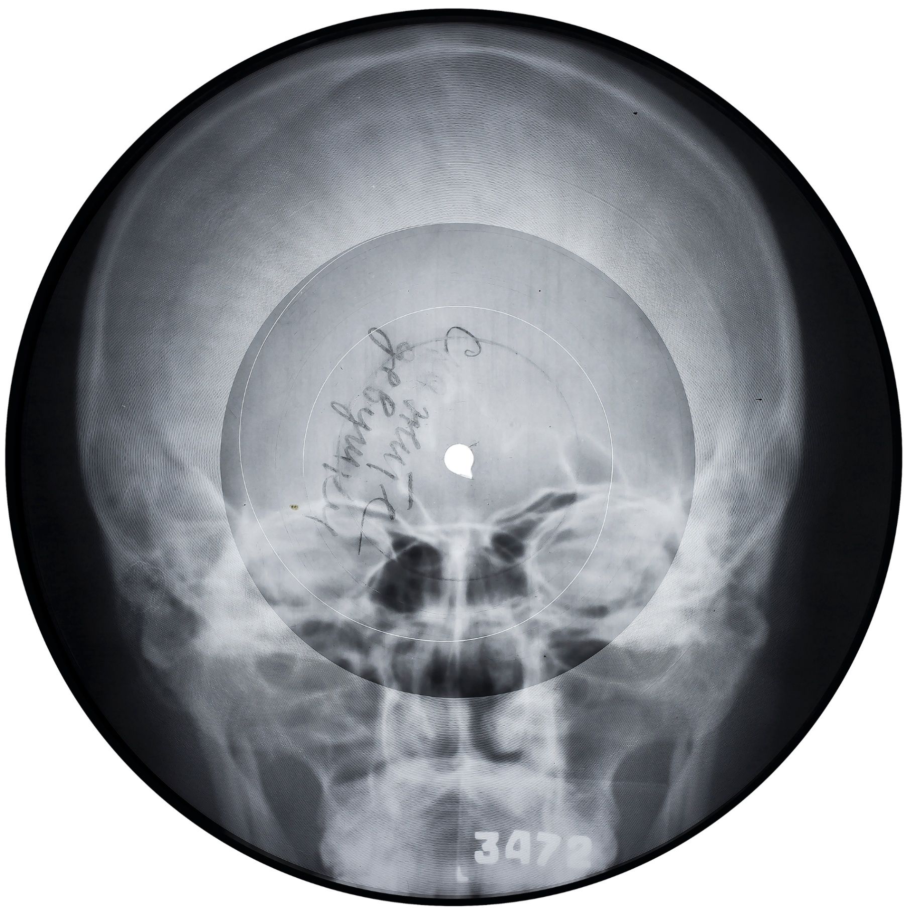  The X-Ray Audio Project,  www.x-rayaudio.com