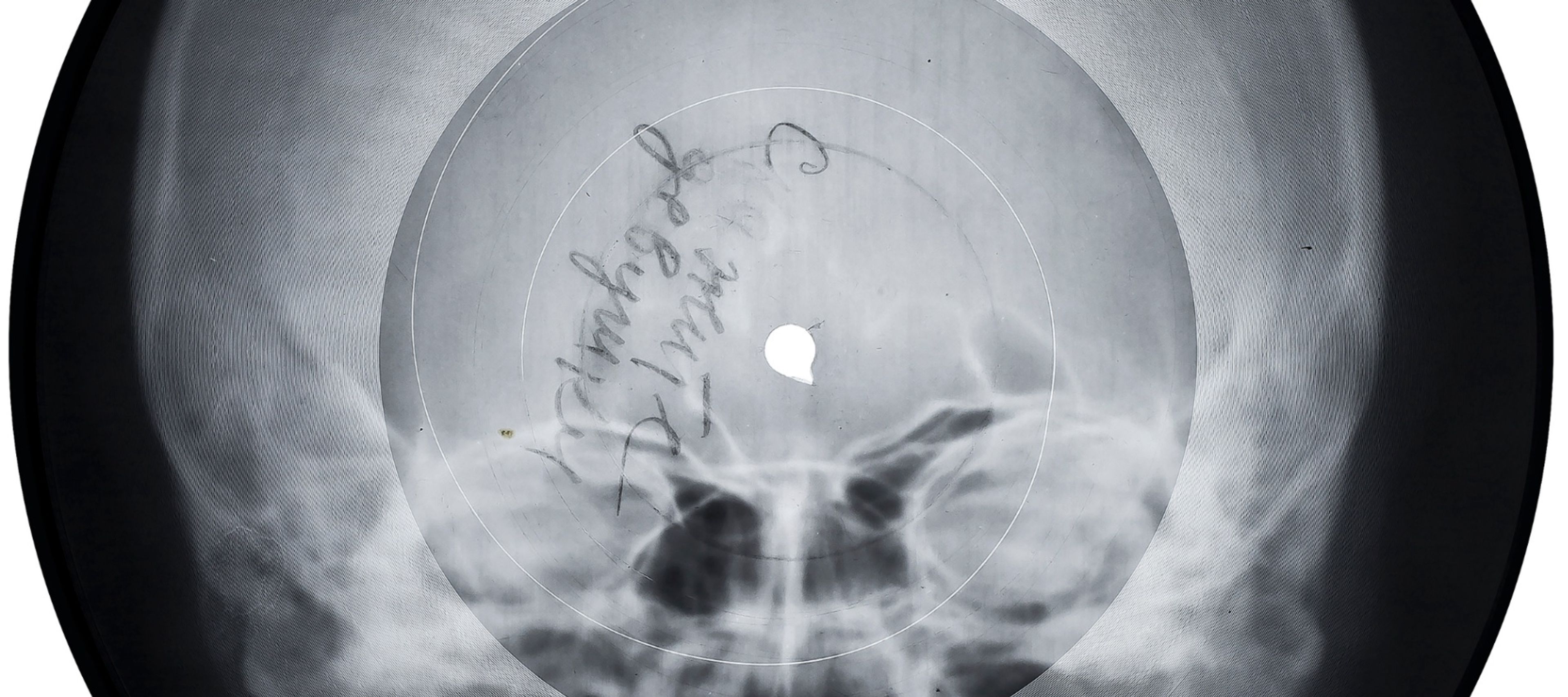 The X-Ray Audio Project, www.x-rayaudio.com