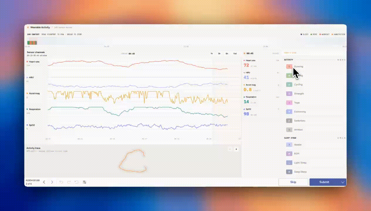 Wearable Activity