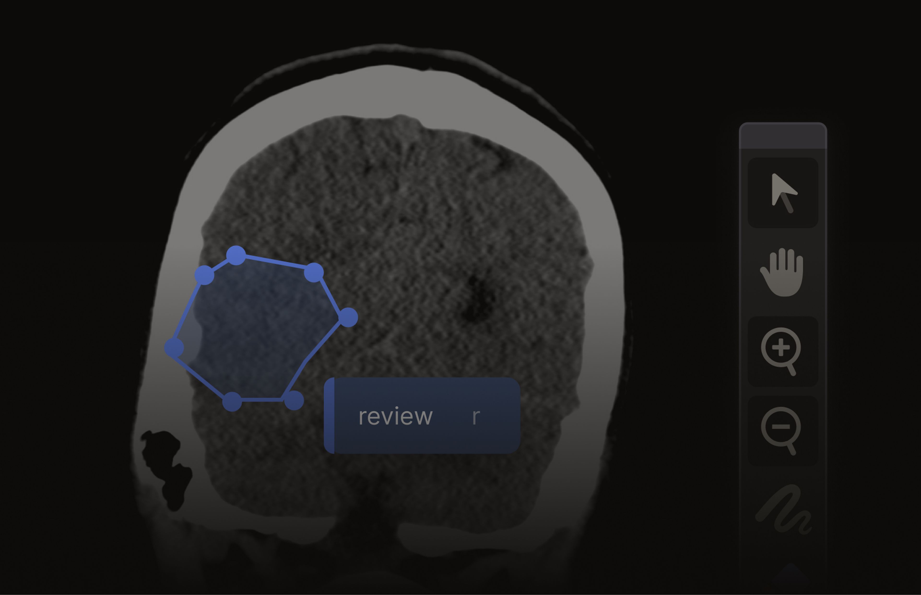 Label Studio for Healthcare | HumanSignal