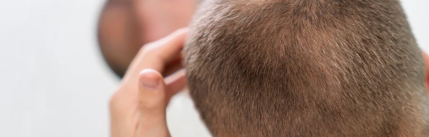 Os melhores tratamentos anticaída para o cabelo e como ajudam a fortalecê-lo