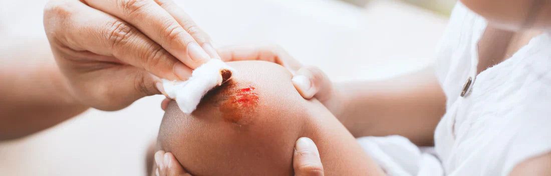 Como tratar uma ferida no verão e promover uma cicatrização adequada