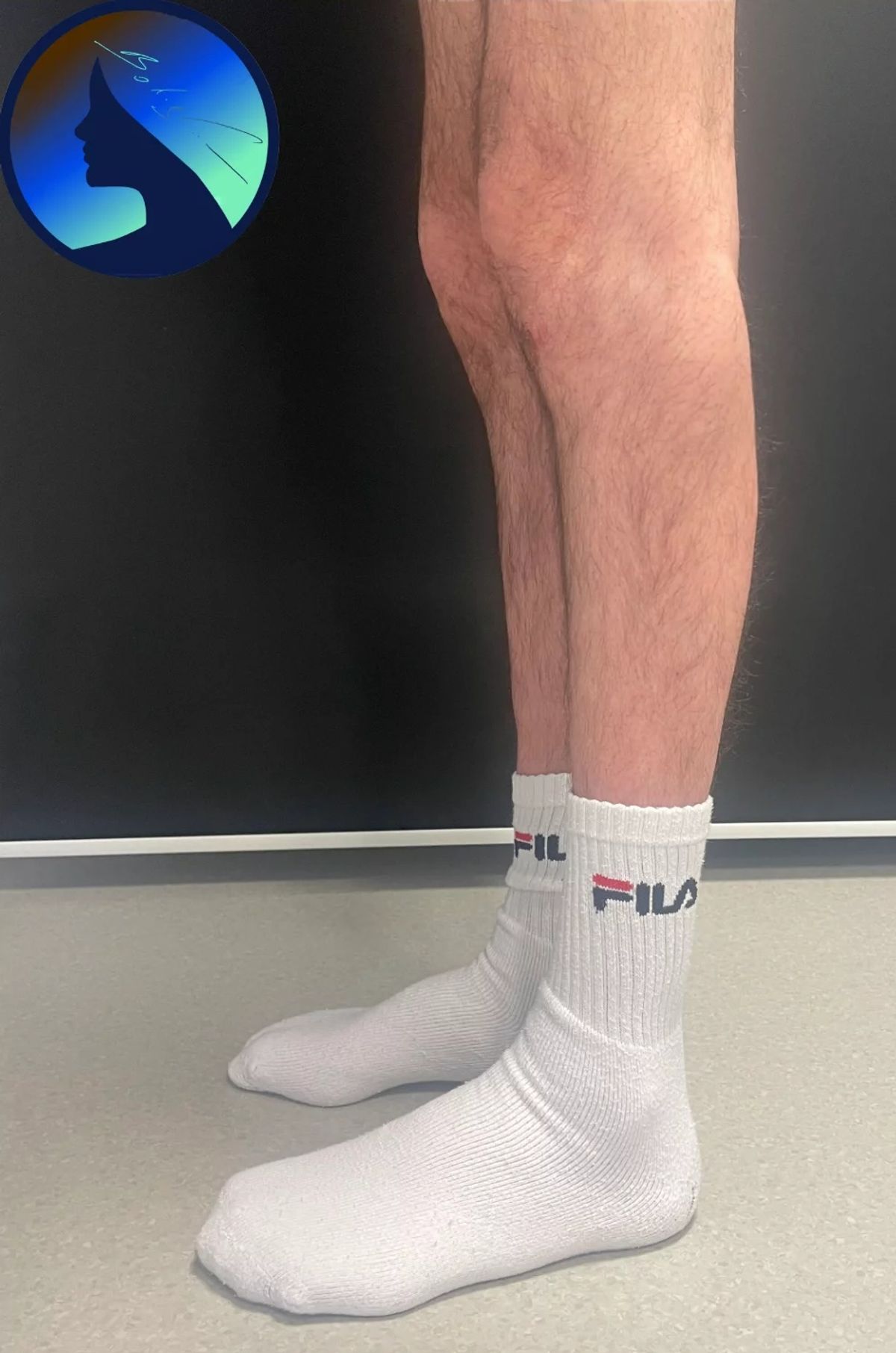Po operacji