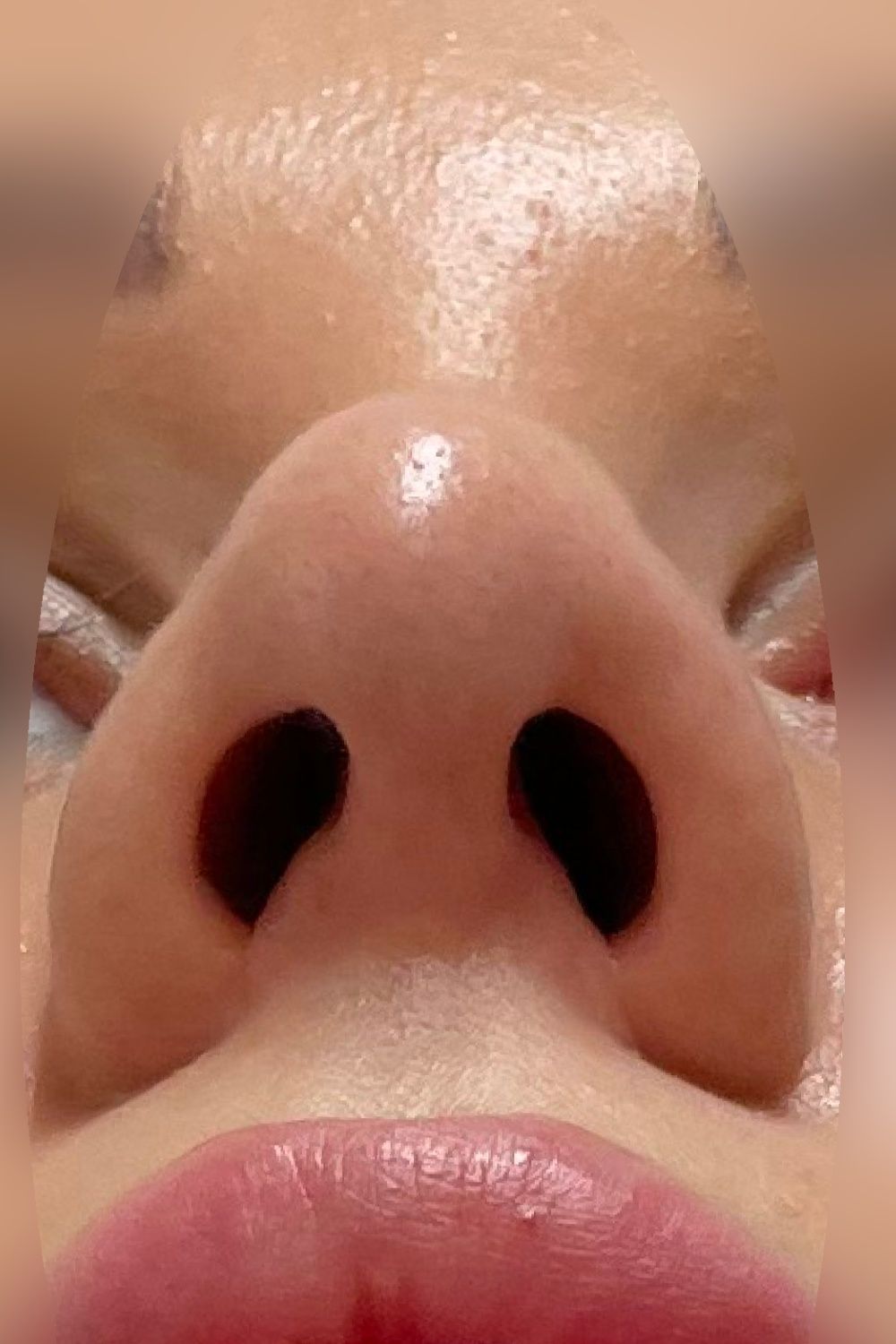Po operacji