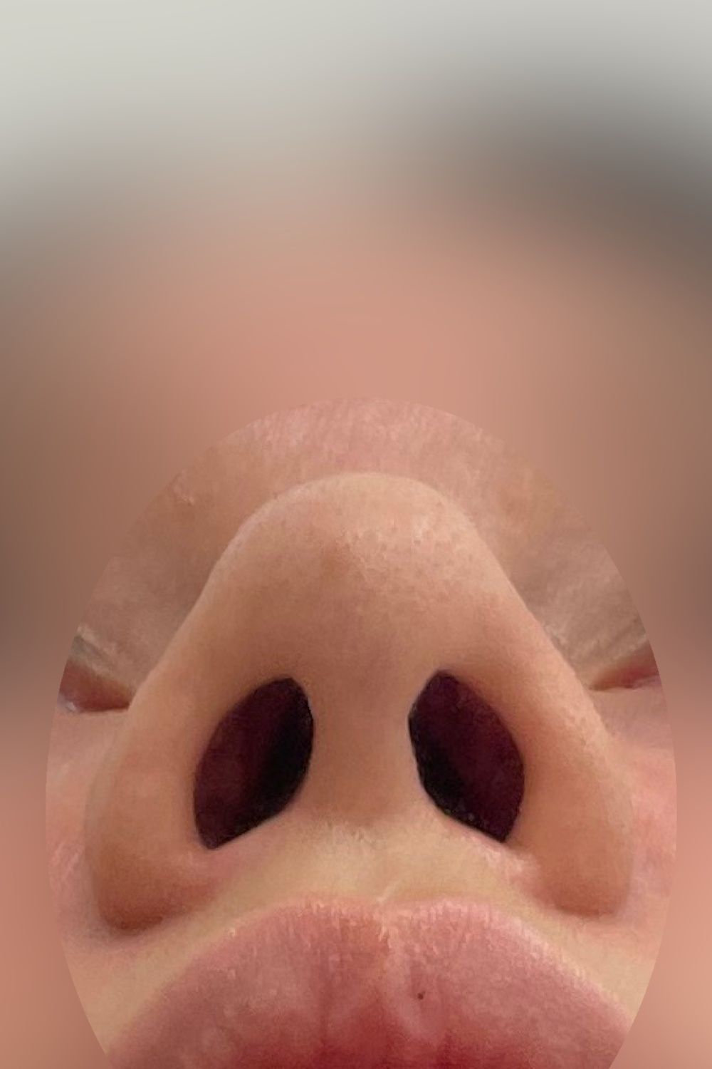 Po operacji