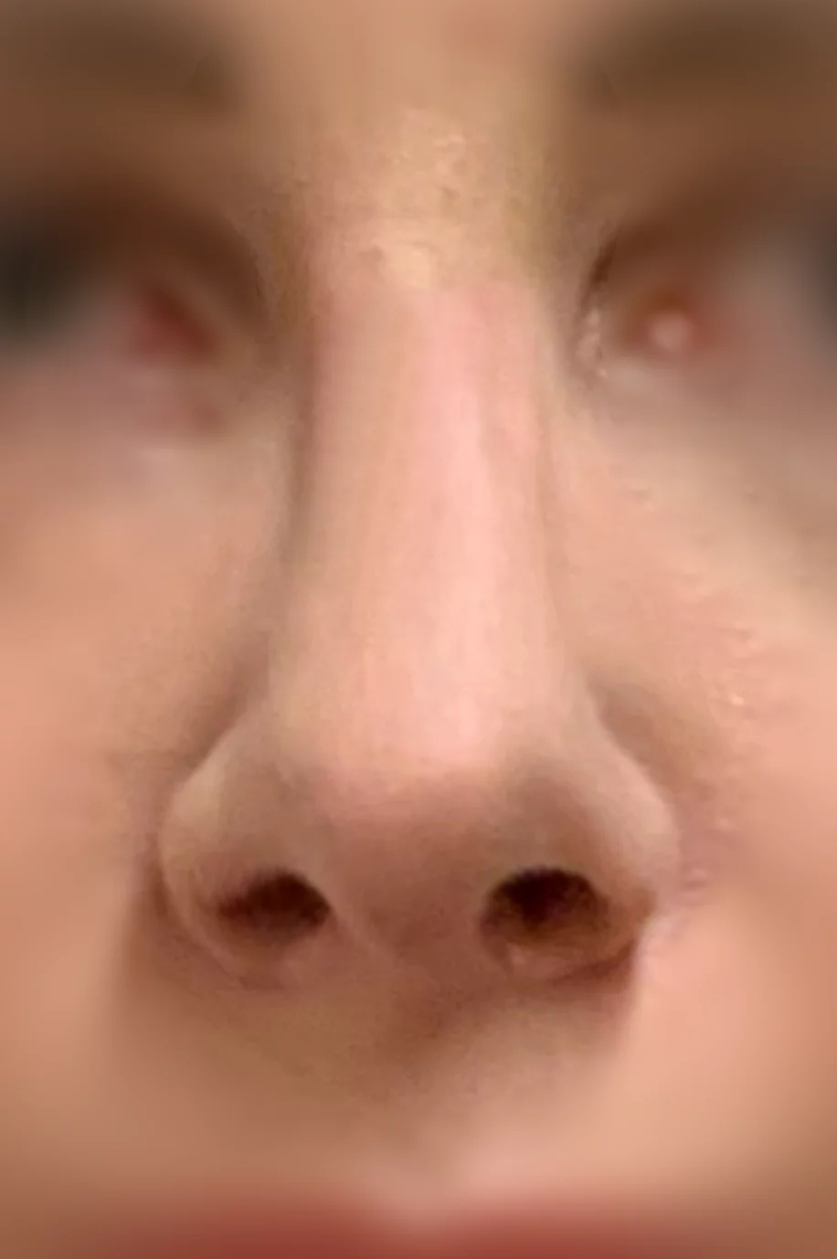 Po operacji