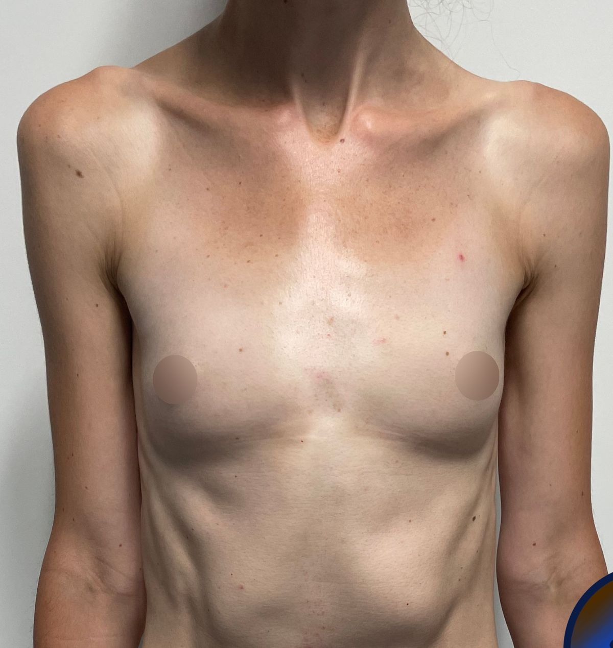 Before surgery