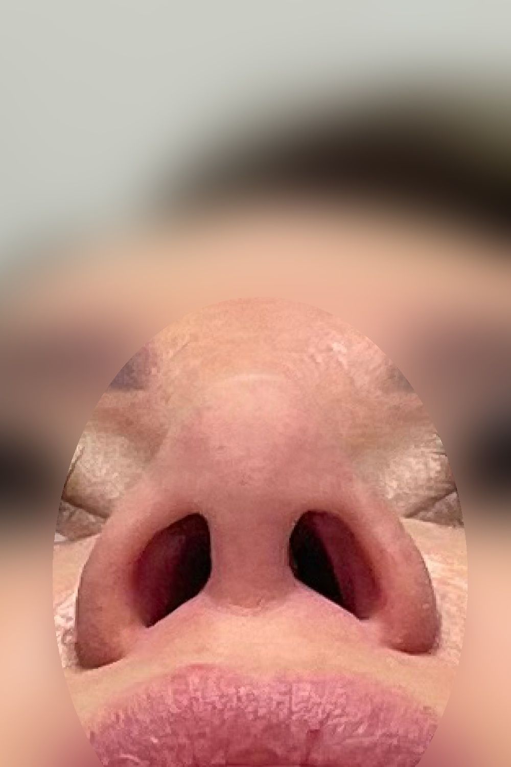 Po operacji