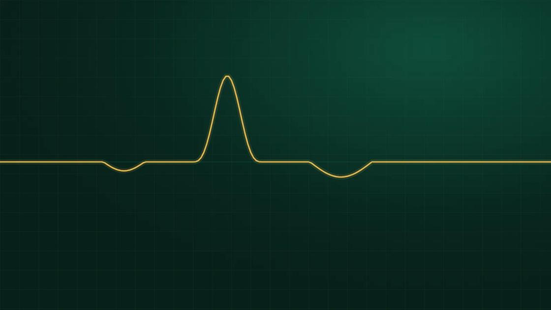 An abstract vital-signs trace drawn in brass on deep forest green, with the NNWA wordmark in the corner.
