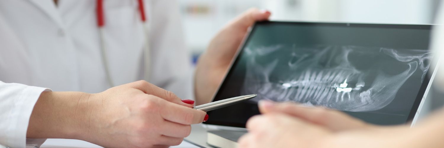 Wypełnienie kompozytowe (plomba)