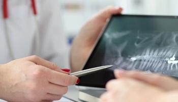 Wypełnienie kompozytowe (plomba)