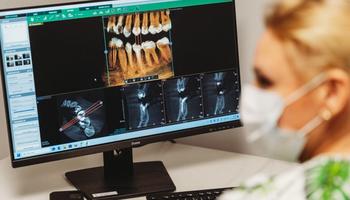 Nowoczesne leczenie próchnicy – bez bólu i bez stresu