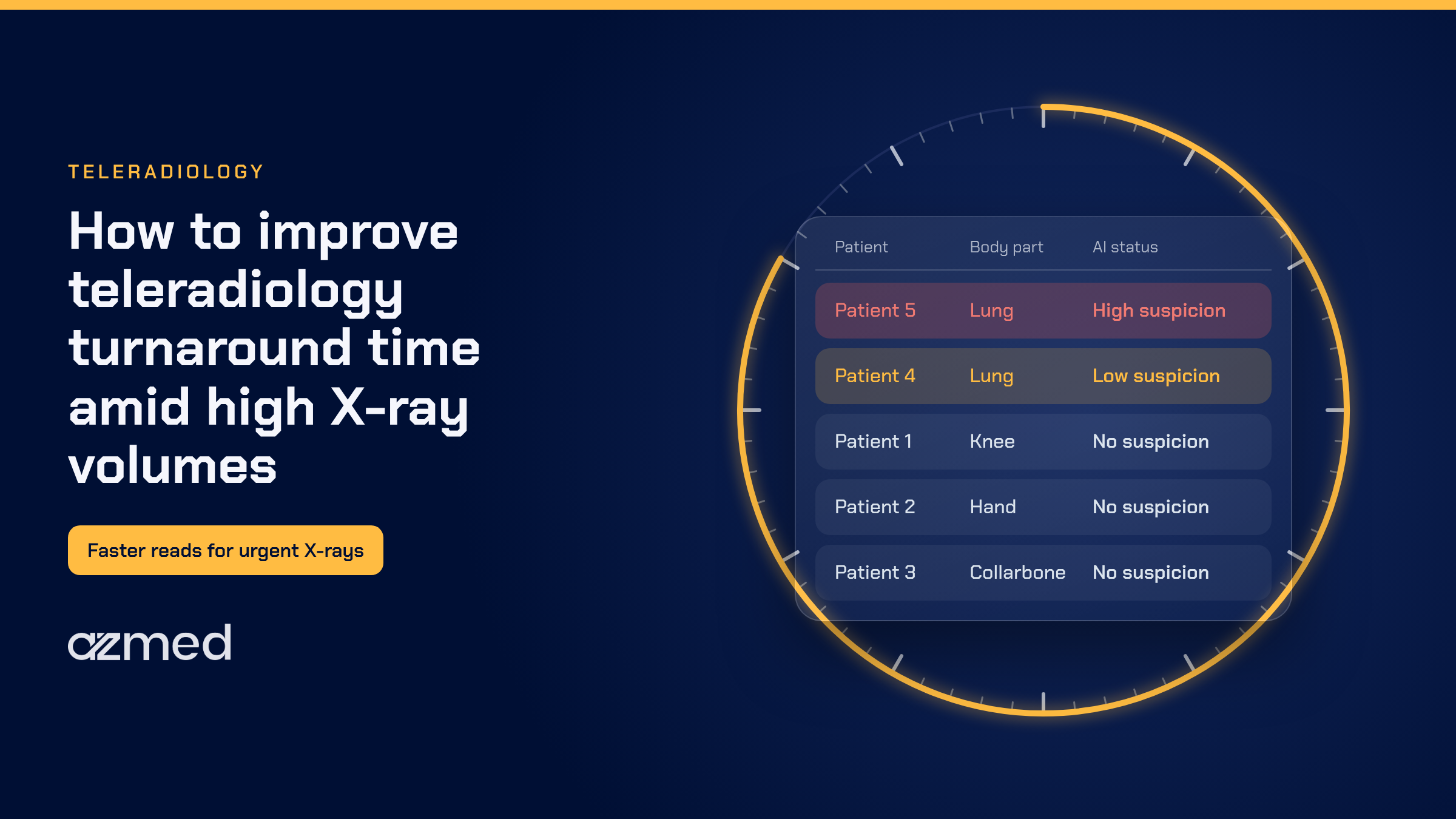 Teleradiology turnaround time with AI worklist triage, shown as a clock around a prioritized X-ray worklist