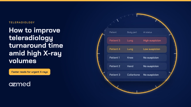 How to improve teleradiology turnaround time amid high X-ray volumes