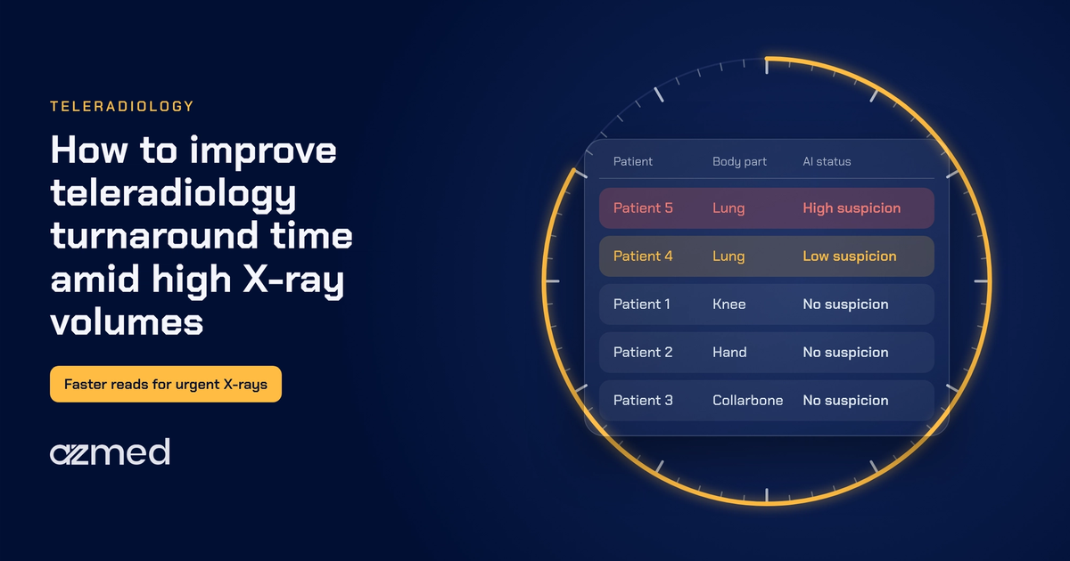 Teleradiology turnaround time with AI worklist triage, shown as a clock around a prioritized X-ray worklist