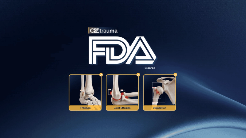 AZtrauma receives expanded FDA clearance for joint effusions and dislocations