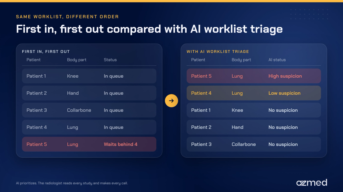 Teleradiology turnaround time with first in, first out reading compared with AI worklist triage