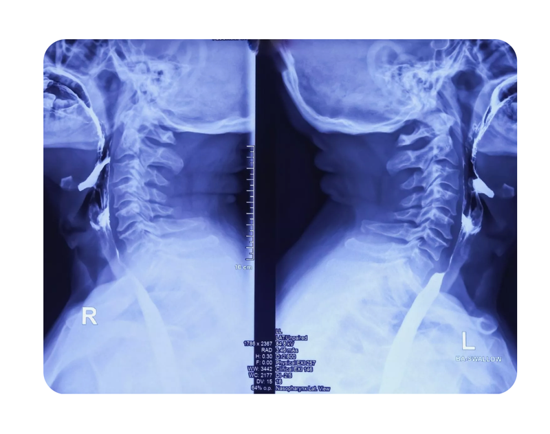 SimonMed leads the largest global study of AI in X-ray