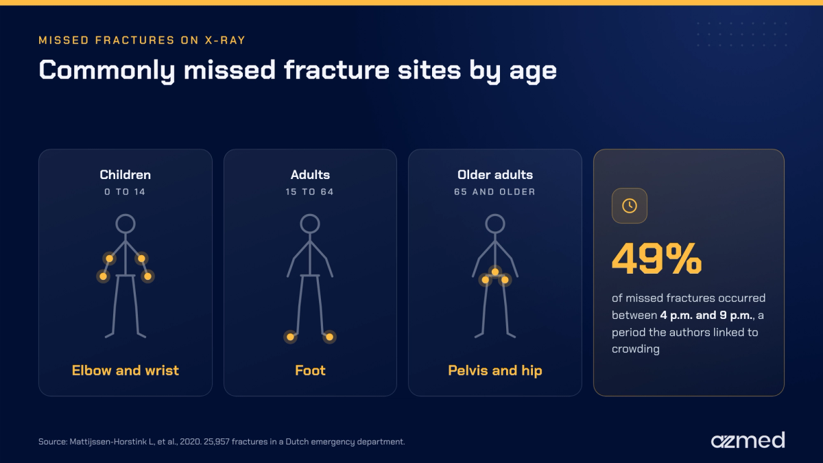 Commonly missed fracture sites by age on X-ray, relevant to AI in radiology in India for fracture detection