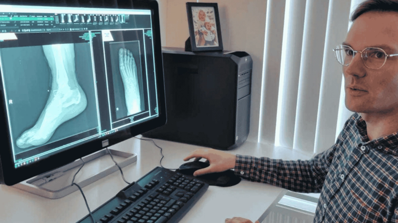 FUJIFILM and AZmed partner to deliver AI-assisted X-Ray analysis through synapse PACS