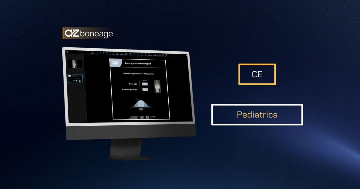 AZboneage: AI for pediatric bone age