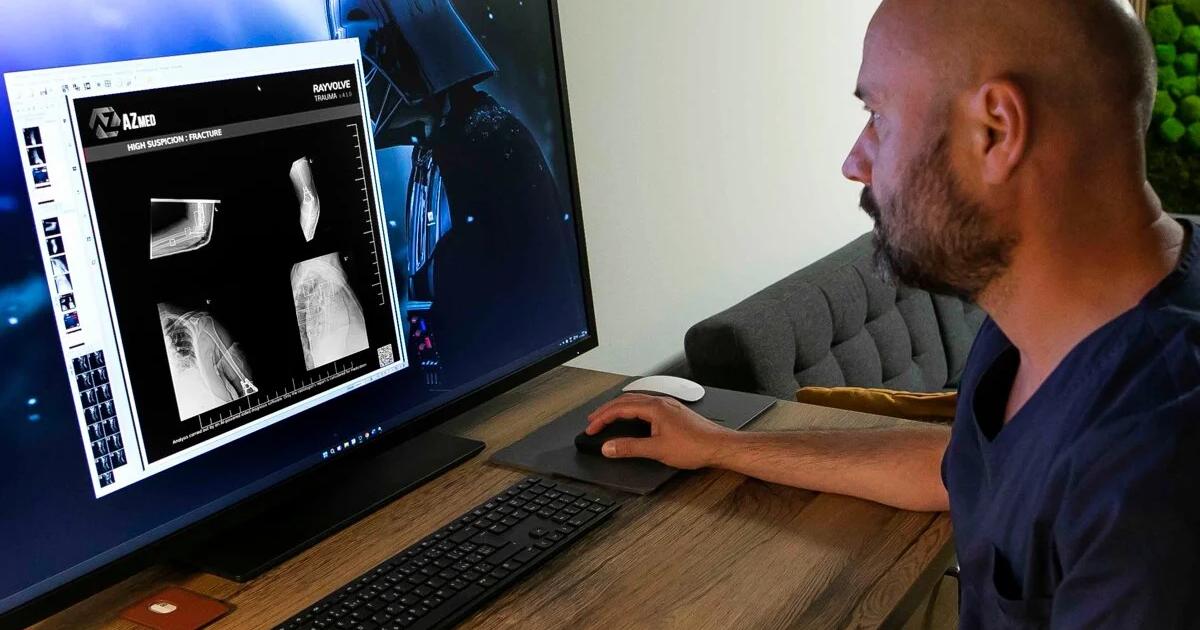 Röntgeny vyhodnocuje v košickej univerzitnej nemocnici aj umelá inteligencia